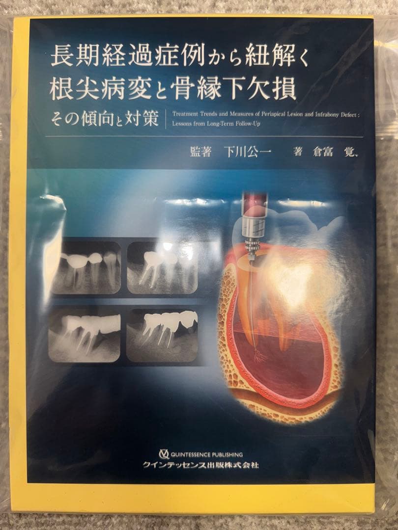 【裁断済み】長期経過症例から紐解く根尖病変と骨縁下欠損