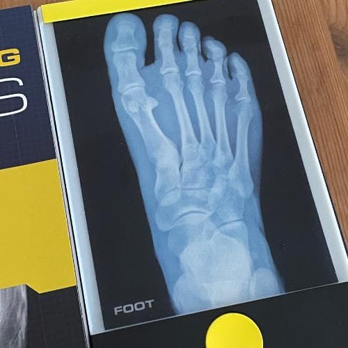 洋書【解剖学・骨格がわかる】レントゲン遊び　AMAZING X-RAYS　人体