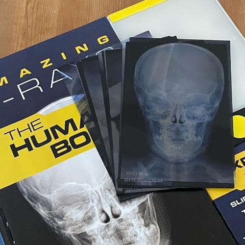 洋書【解剖学・骨格がわかる】レントゲン遊び　AMAZING X-RAYS　人体