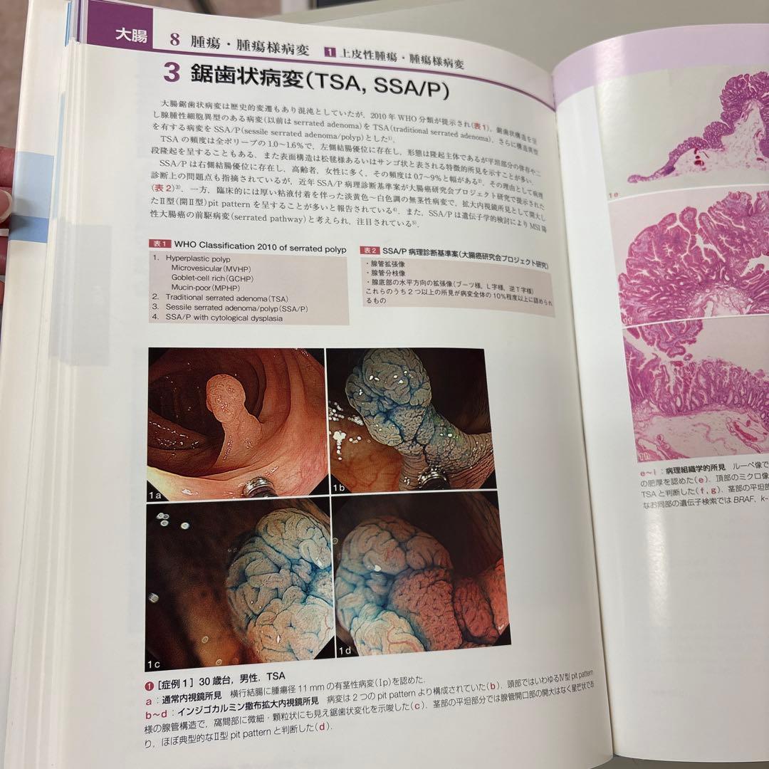 胃と腸アトラスⅠ 上部消化管、II 下部消化管 第2版