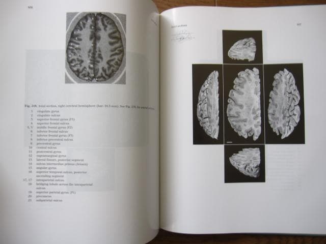 洋書 Duvernoy The Human Brain Second edition