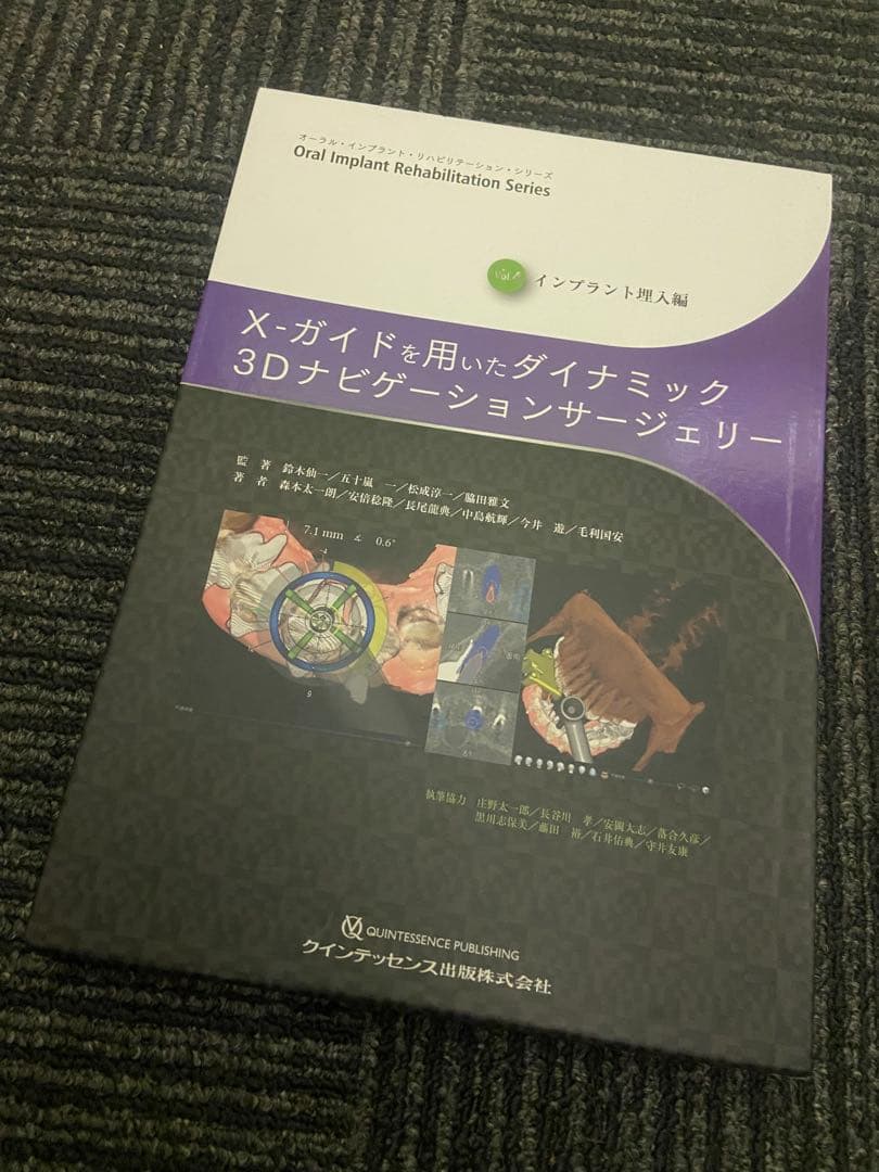 X-ガイドを用いたダイナミック3Dナビゲーションサージェリー インプラント埋入編